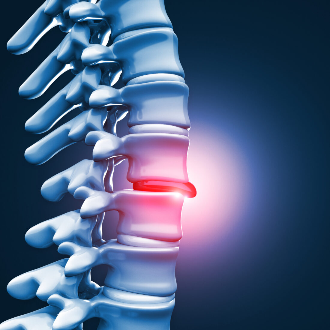 gabapentin for surgery pain