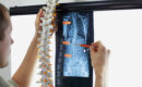 A specialist comparing X-rays to a model of the human spine to determine whether a patient requires advanced spine surgery.