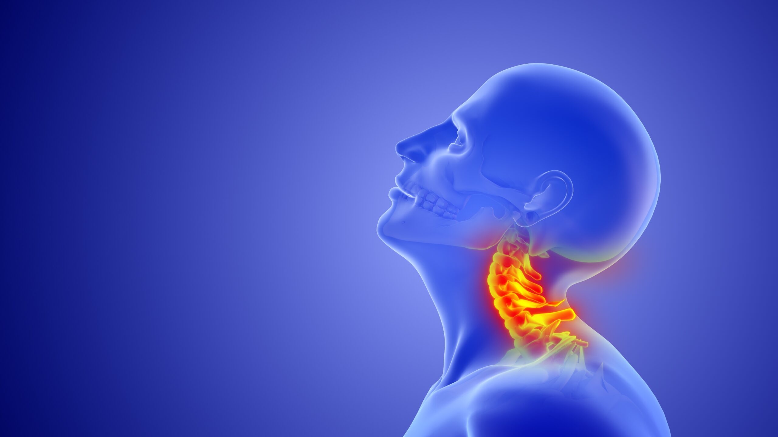 A trusted cervical disc fusion surgery illustration that depicts the bone structure of one's cervical neck anatomy.