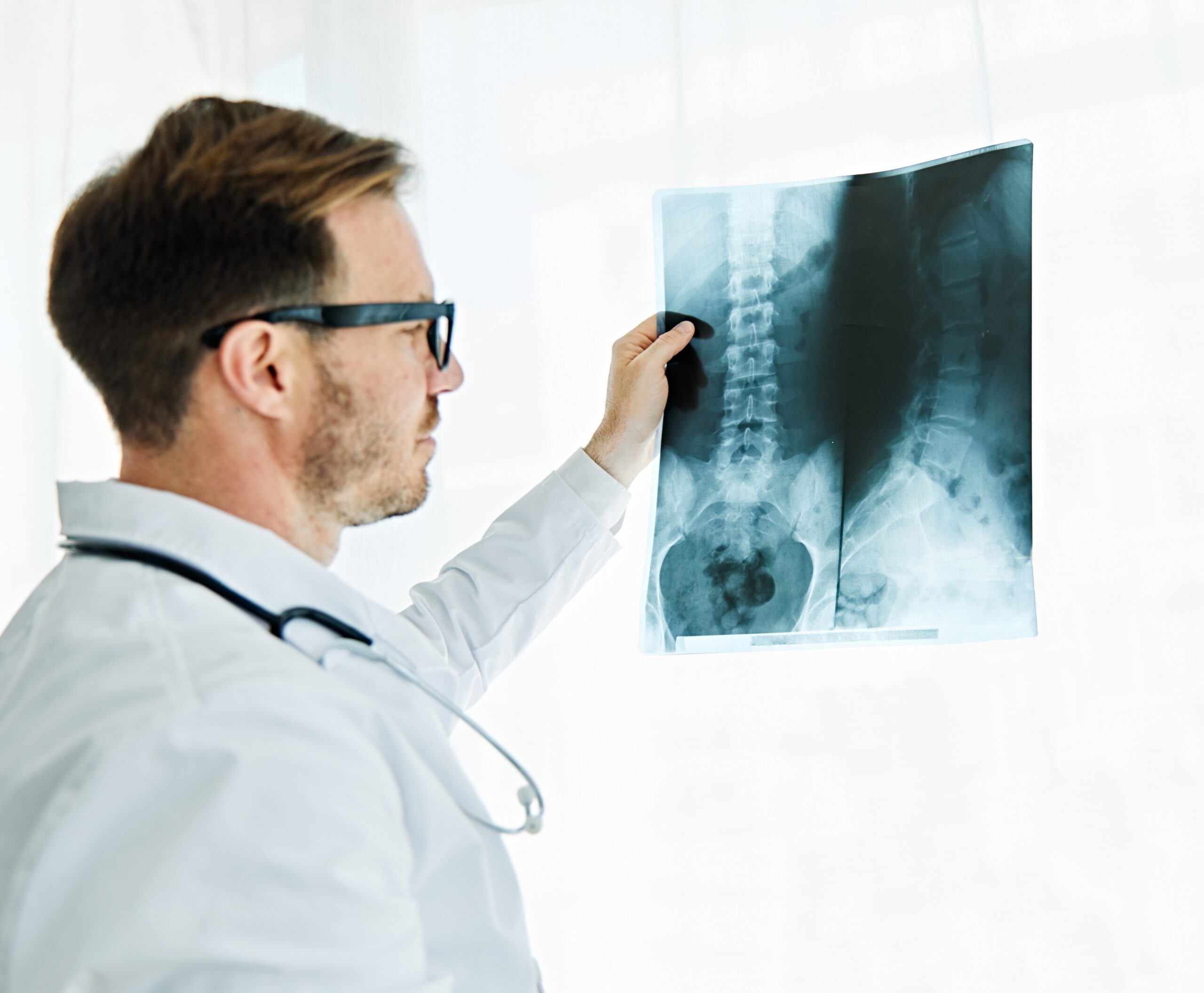 A spine doctor reviews X-rays while thinking about how you can find an experienced spine specialist near you.